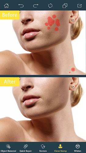 Photo Retouch-Object Removal Скриншот 1