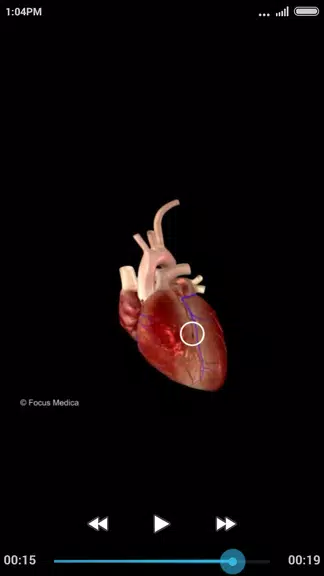 Cardiology-Animated Dictionary 螢幕截圖 2