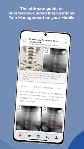 Interventional Pain App ဖန်သားပြင်ဓာတ်ပုံ 3