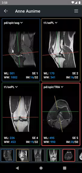 IDV - IMAIOS DICOM Viewer 螢幕截圖 2