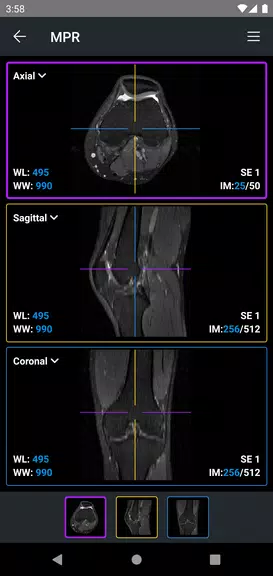 IDV - IMAIOS DICOM Viewer Ảnh chụp màn hình 3