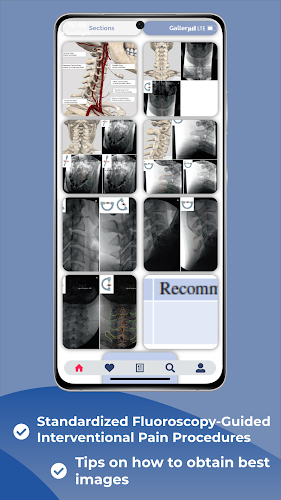 Interventional Pain App ဖန်သားပြင်ဓာတ်ပုံ 2